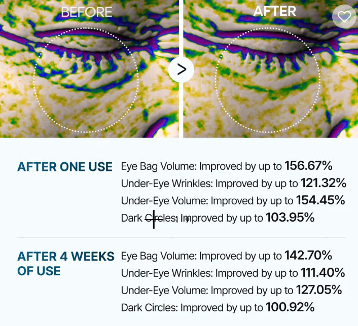 Eyephalt Eyebag Cream