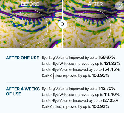 Eyephalt Eyebag Cream